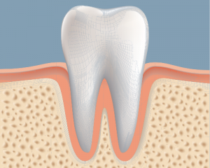 'tooth needing bone graft'